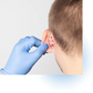 Otoplastias (cirugía de orejas):