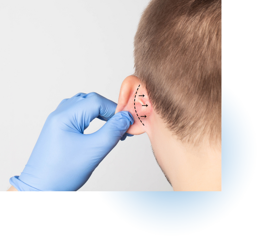 Otoplastias (cirugía de orejas):